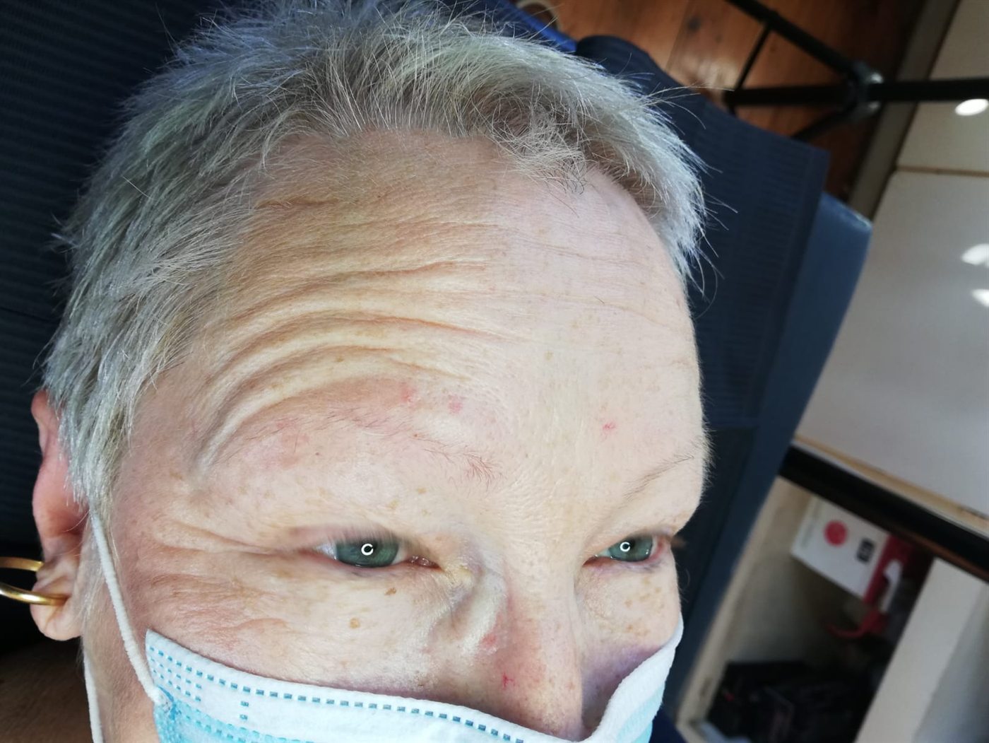 Client's sparse brows before microblading